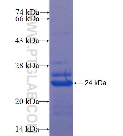 ISCU fusion protein Ag6568 SDS-PAGE