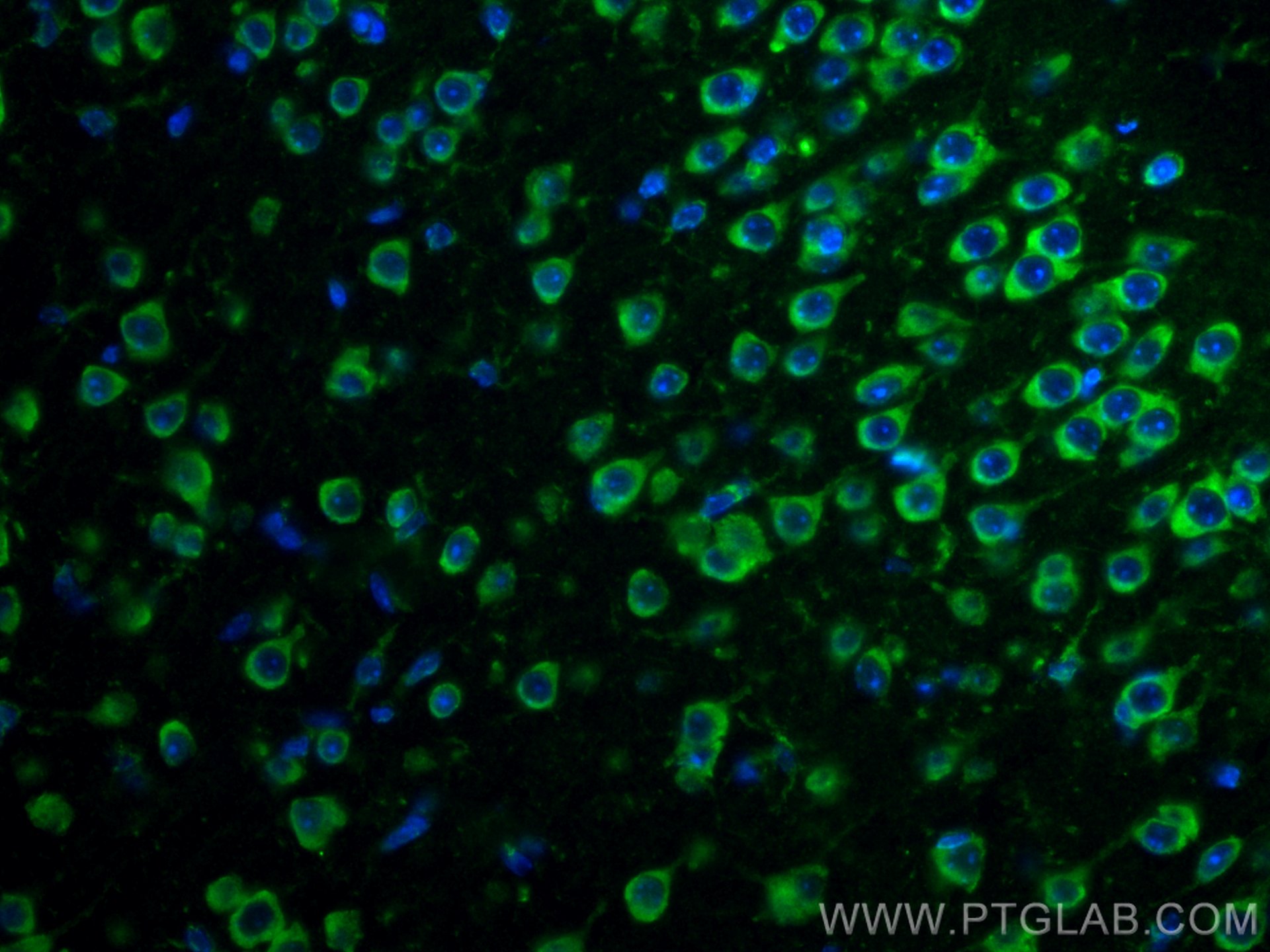 Immunofluorescence (IF) / fluorescent staining of mouse brain tissue using ISG15 Polyclonal antibody (15981-1-AP)