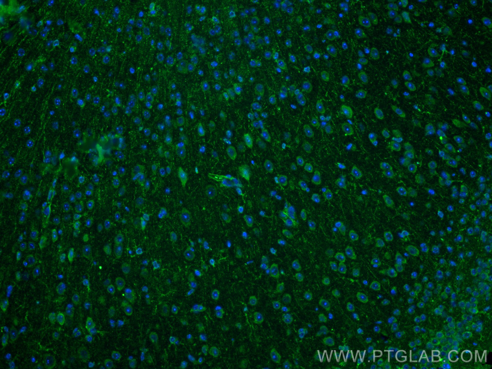 Immunofluorescence (IF) / fluorescent staining of mouse brain tissue using ISG15 Polyclonal antibody (15981-1-AP)