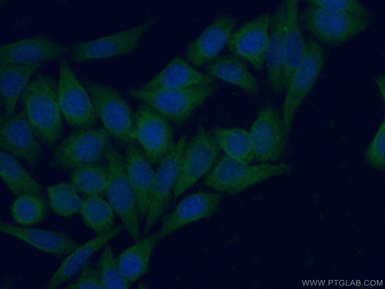 Immunofluorescence (IF) / fluorescent staining of HeLa cells using ISG15 Polyclonal antibody (15981-1-AP)