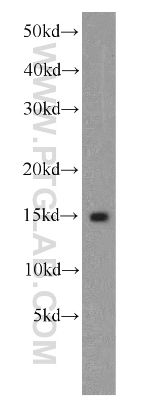 Western Blot (WB) analysis of human brain tissue using ISG15 Polyclonal antibody (15981-1-AP)