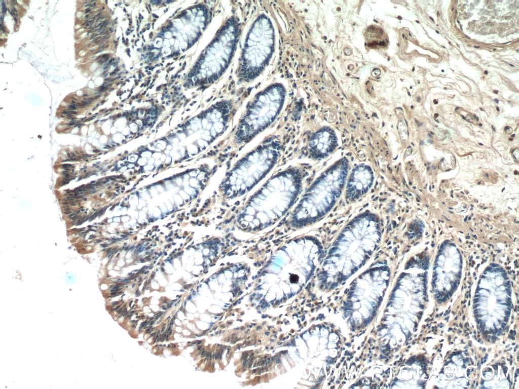 Immunohistochemistry (IHC) staining of human colon tissue using ISG20 Polyclonal antibody (22097-1-AP)