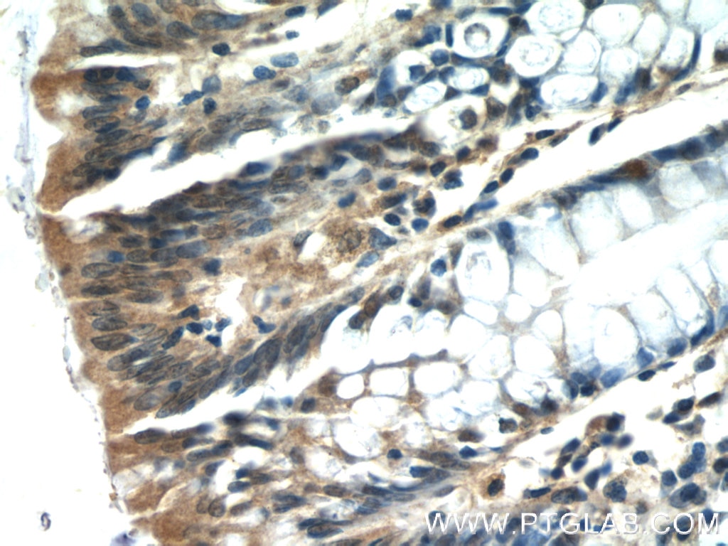 Immunohistochemistry (IHC) staining of human colon tissue using ISG20 Polyclonal antibody (22097-1-AP)