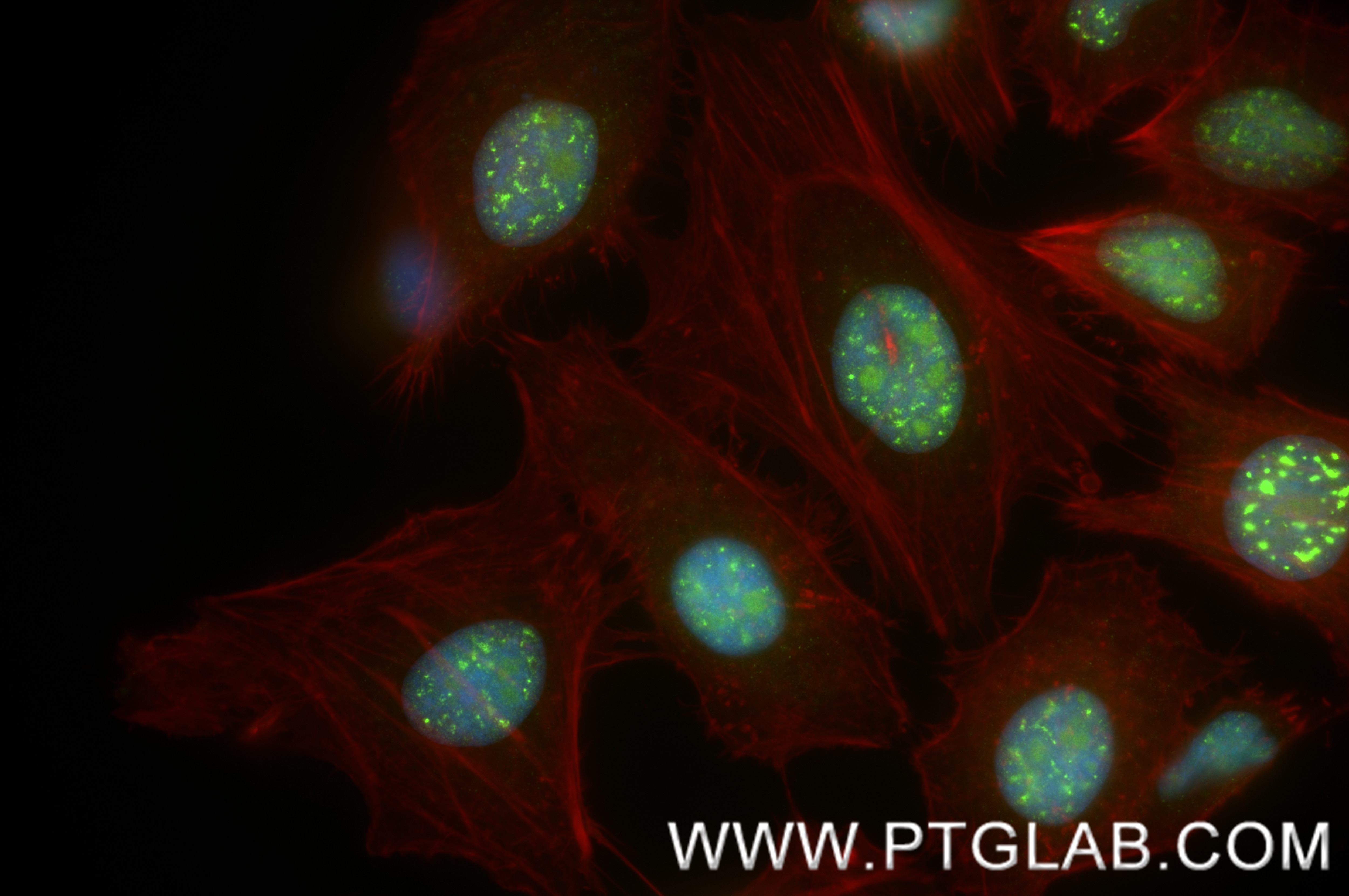 Immunofluorescence (IF) / fluorescent staining of HeLa cells using ISG20L2 Recombinant antibody (85992-2-RR)
