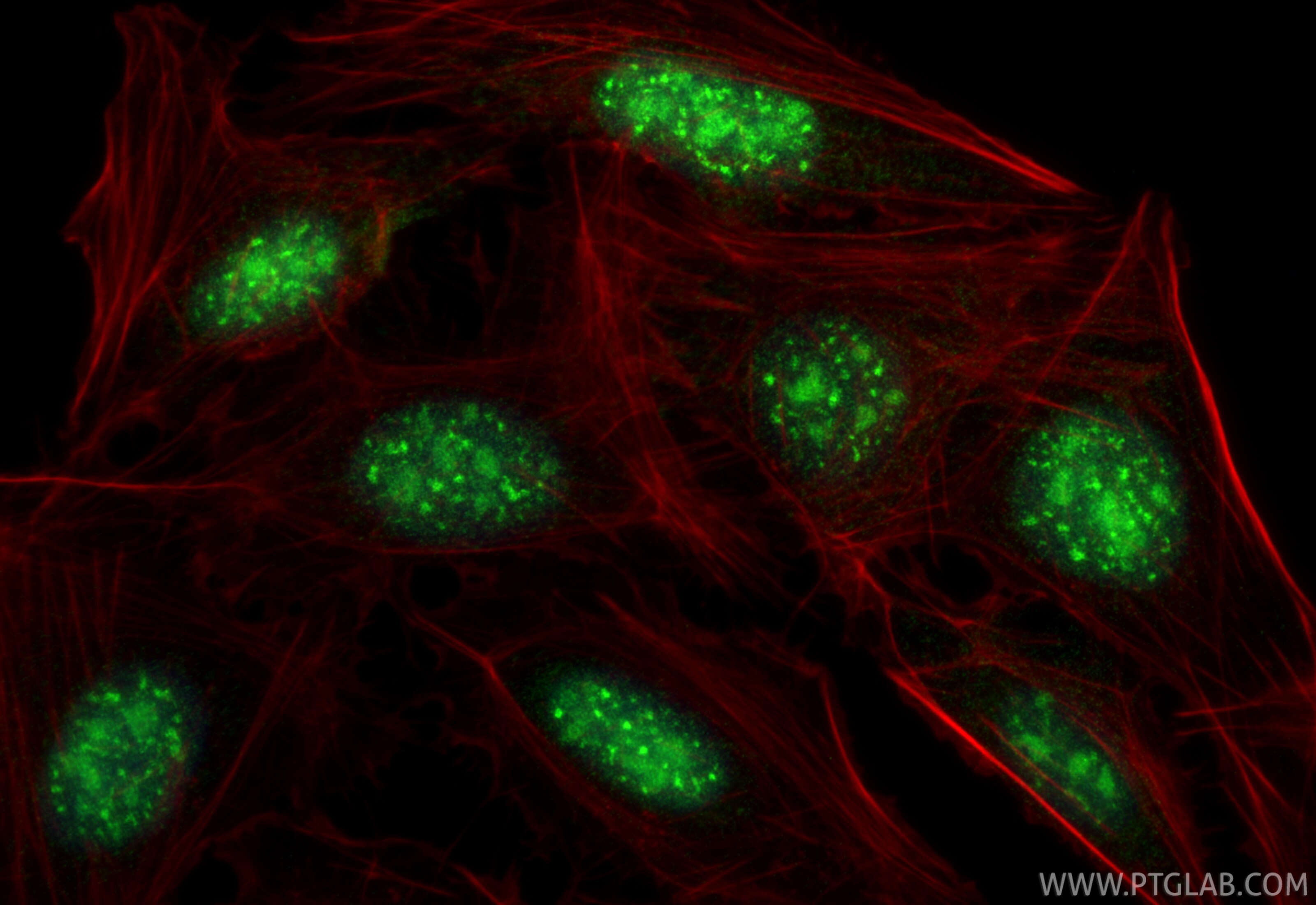 Immunofluorescence (IF) / fluorescent staining of U2OS cells using ISG20L2 Recombinant monoclonal antibody (85992-2-RR)