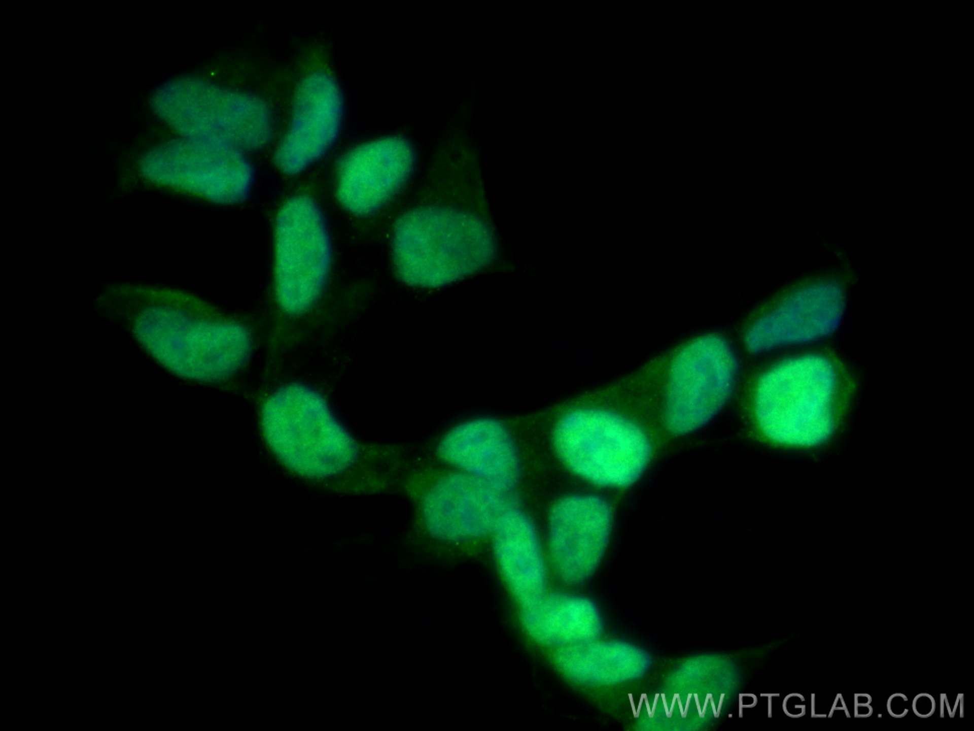 Immunofluorescence (IF) / fluorescent staining of SH-SY5Y cells using Islet 1 Polyclonal antibody (15661-1-AP)