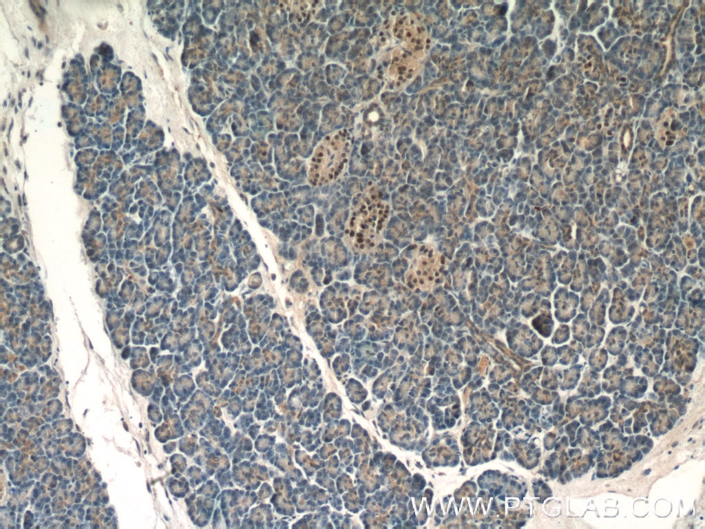 Immunohistochemistry (IHC) staining of human pancreas tissue using Islet 1 Polyclonal antibody (15661-1-AP)