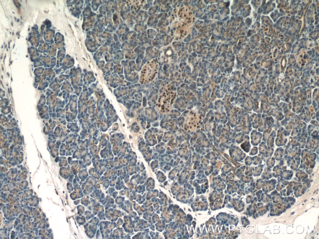 IHC staining of human pancreas using 15661-1-AP