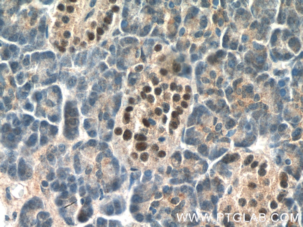 Immunohistochemistry (IHC) staining of human pancreas tissue using Islet 1 Polyclonal antibody (15661-1-AP)
