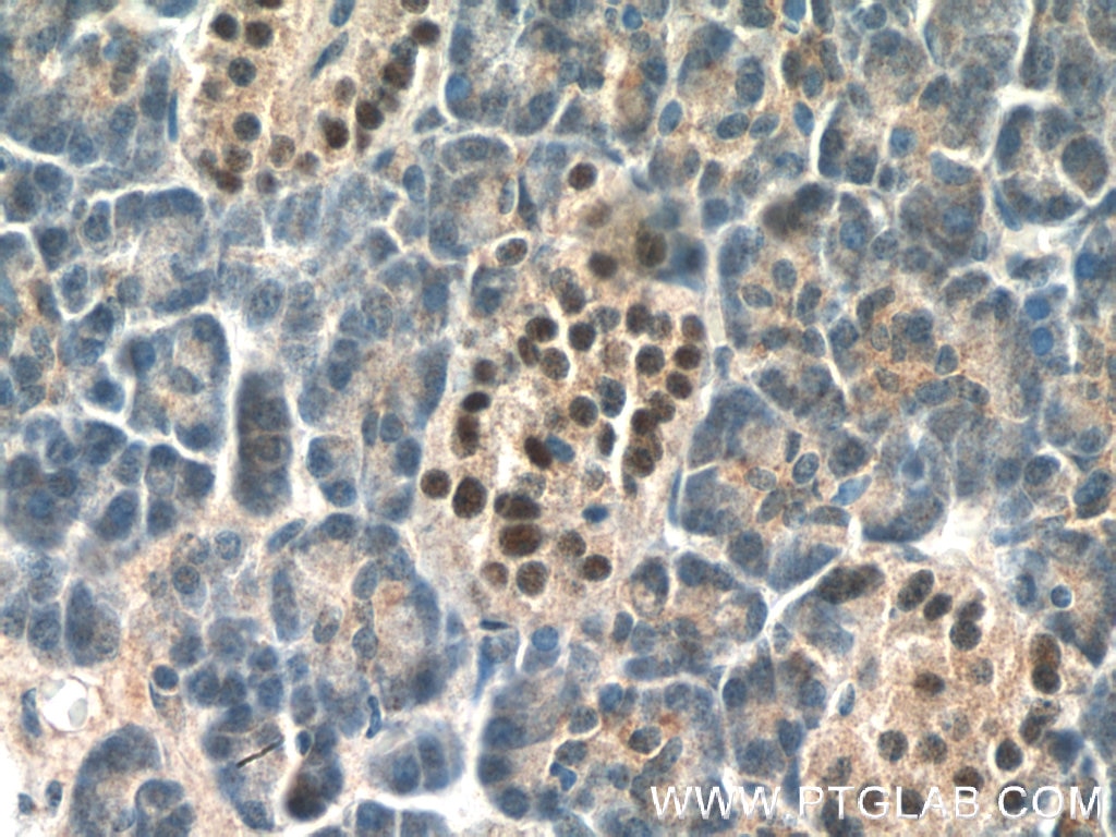 IHC staining of human pancreas using 15661-1-AP