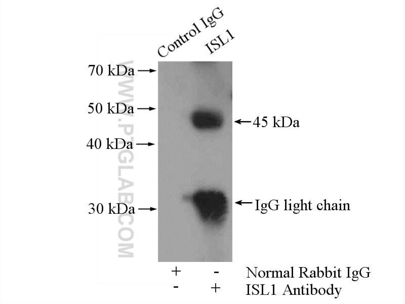 Immunoprecipitation (IP) experiment of HeLa cells using Islet 1 Polyclonal antibody (15661-1-AP)