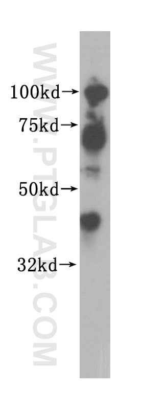 Western Blot (WB) analysis of HeLa cells using Islet 1 Polyclonal antibody (15661-1-AP)