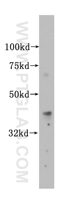 Western Blot (WB) analysis of BxPC-3 cells using Islet 1 Polyclonal antibody (15661-1-AP)