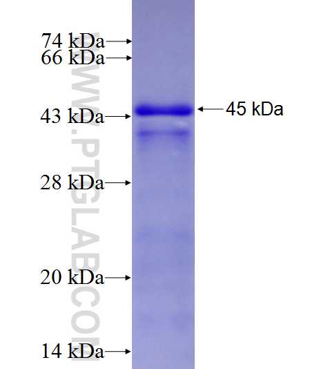 Islet 1 fusion protein Ag8088 SDS-PAGE