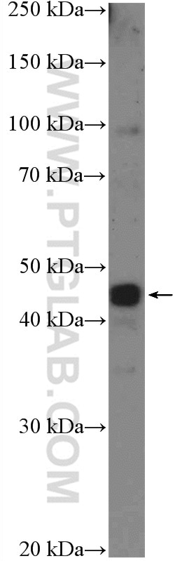 Western Blot (WB) analysis of Neuro-2a cells using ISL2 Polyclonal antibody (18659-1-AP)