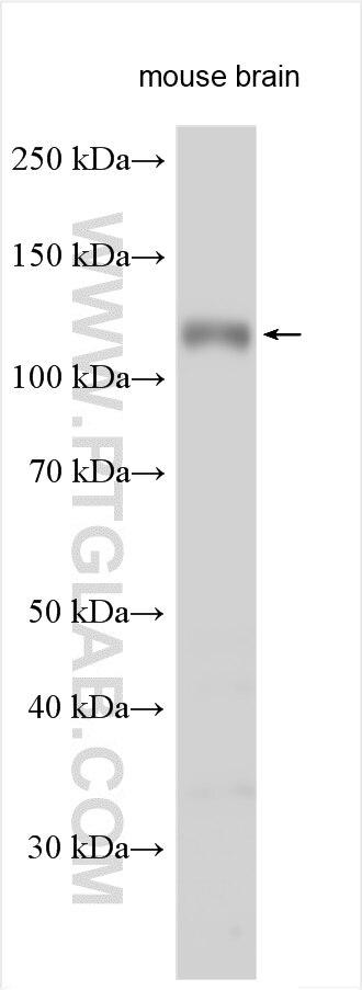 Western Blot (WB) analysis of various lysates using ISLR2 Polyclonal antibody (24814-1-AP)