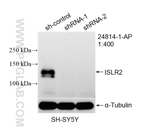 WB analysis using 24814-1-AP (same clone as 24814-1-PBS) Western Blot (WB) analysis of various lysates using ISLR2 Polyclonal antibody (24814-1-AP)