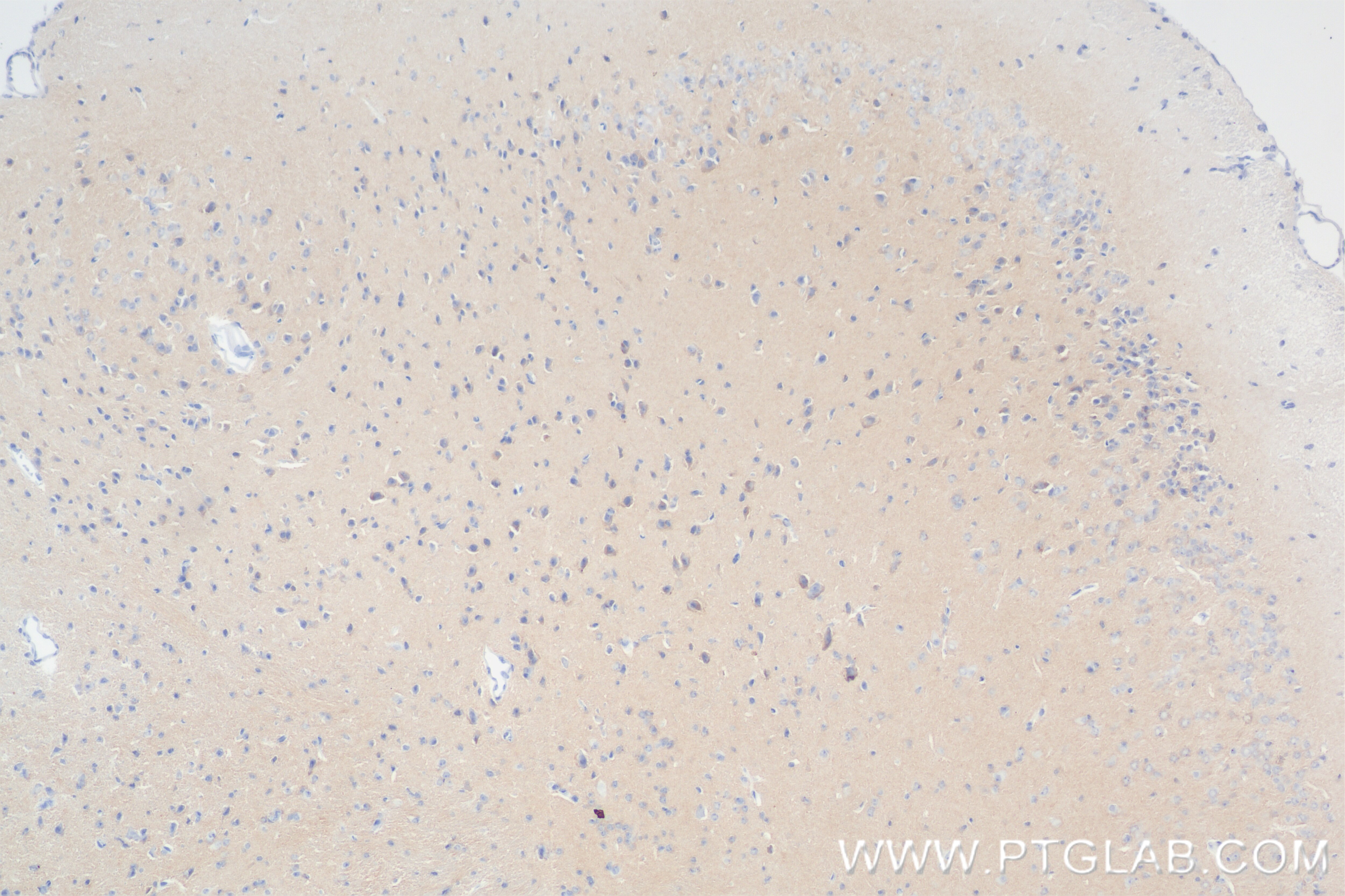 Immunohistochemistry (IHC) staining of mouse brain tissue using ISLR2 Recombinant antibody (84076-3-RR)