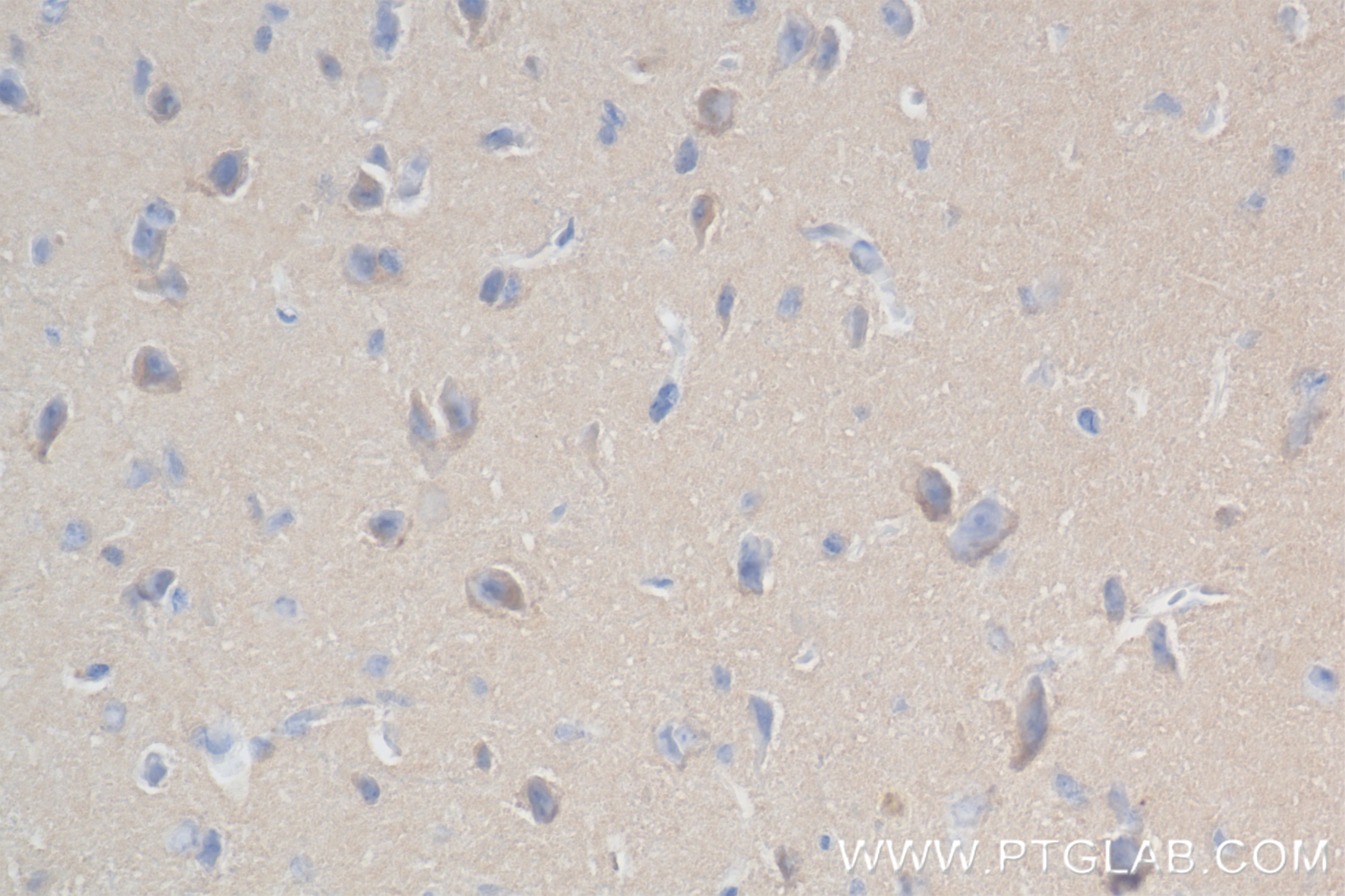 Immunohistochemistry (IHC) staining of mouse brain tissue using ISLR2 Recombinant antibody (84076-3-RR)
