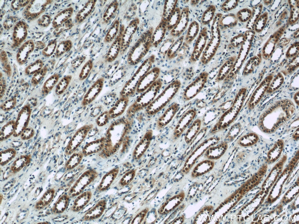 Immunohistochemistry (IHC) staining of human kidney tissue using ISM2 Polyclonal antibody (21540-1-AP)