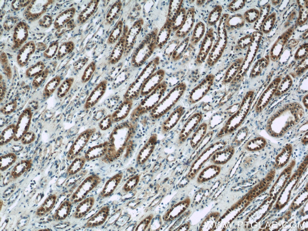 IHC staining of human kidney using 21540-1-AP