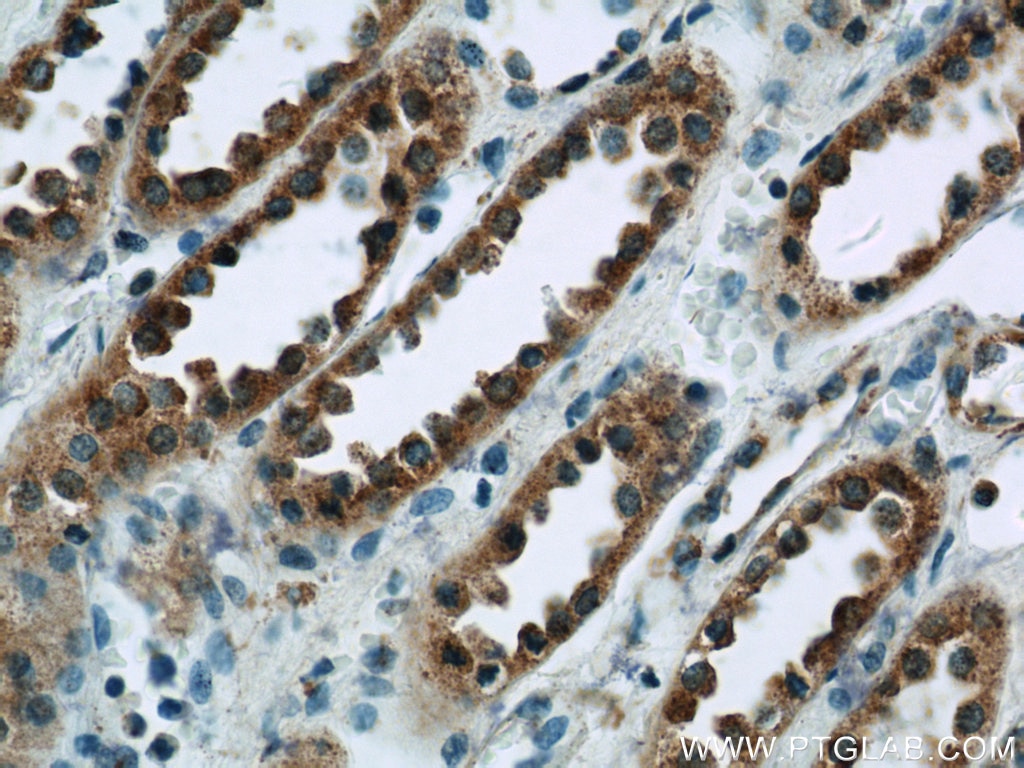 IHC staining of human kidney using 21540-1-AP