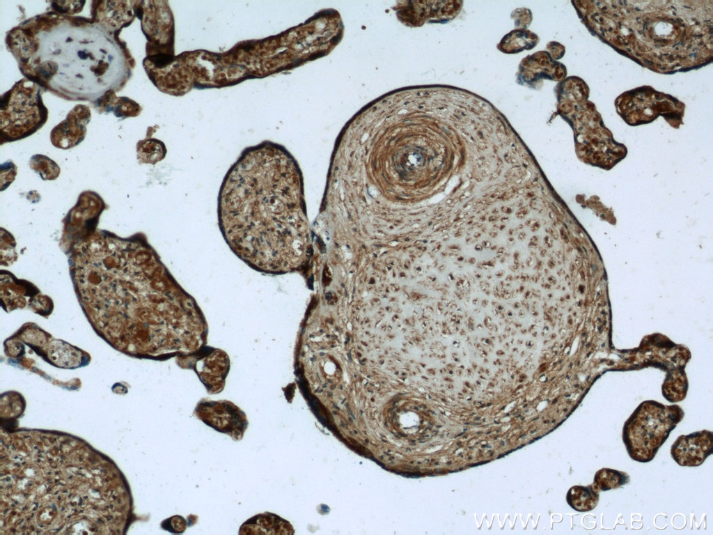 IHC staining of human placenta using 21540-1-AP