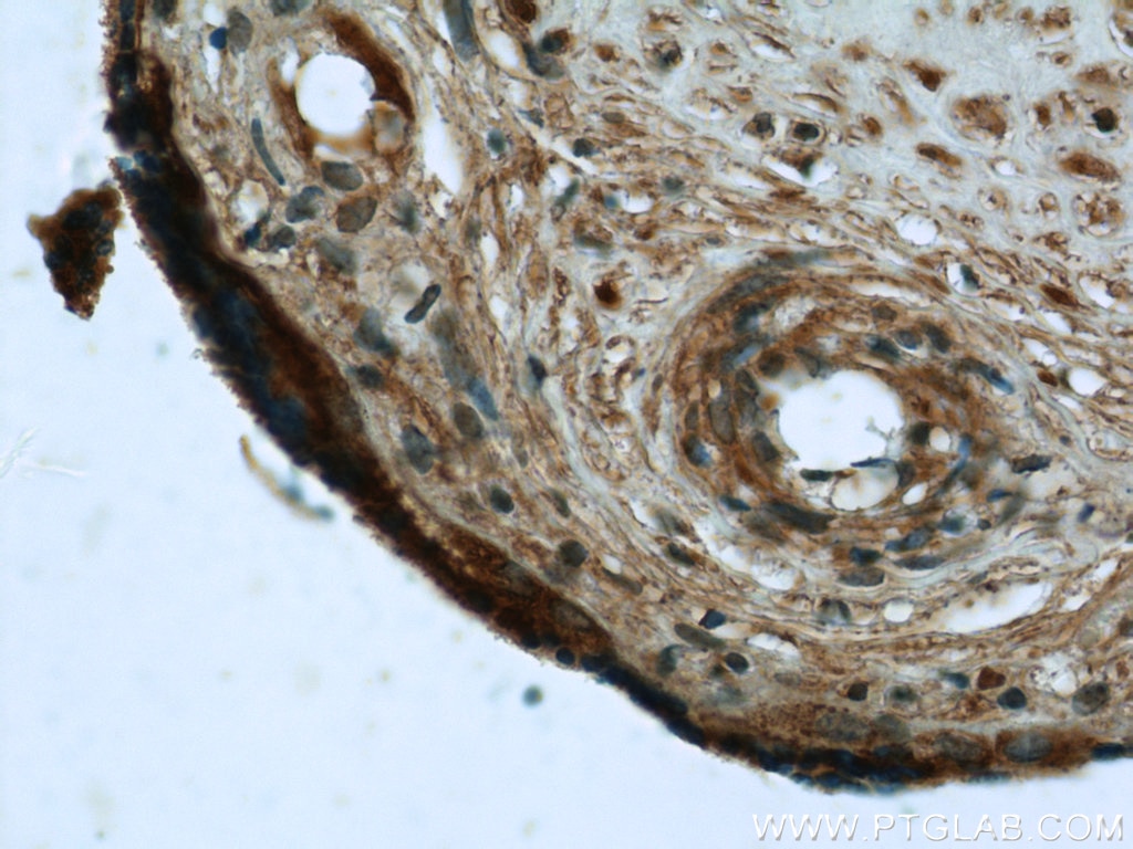 Immunohistochemistry (IHC) staining of human placenta tissue using ISM2 Polyclonal antibody (21540-1-AP)