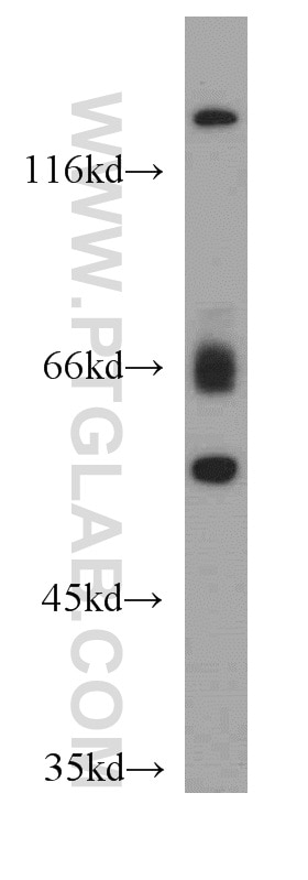 Western Blot (WB) analysis of L02 cells using ISM2 Polyclonal antibody (21540-1-AP)