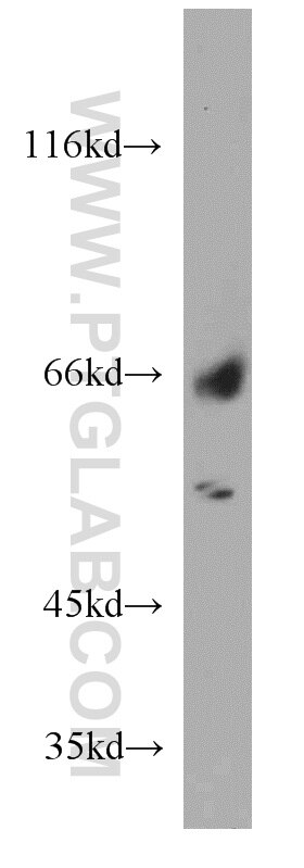 Western Blot (WB) analysis of mouse skin tissue using ISM2 Polyclonal antibody (21540-1-AP)