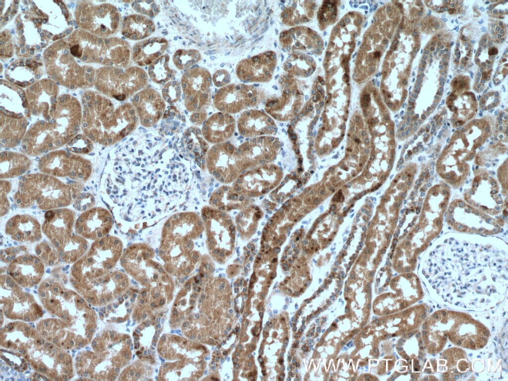 Immunohistochemistry (IHC) staining of human kidney tissue using ISOC2 Polyclonal antibody (27082-1-AP)