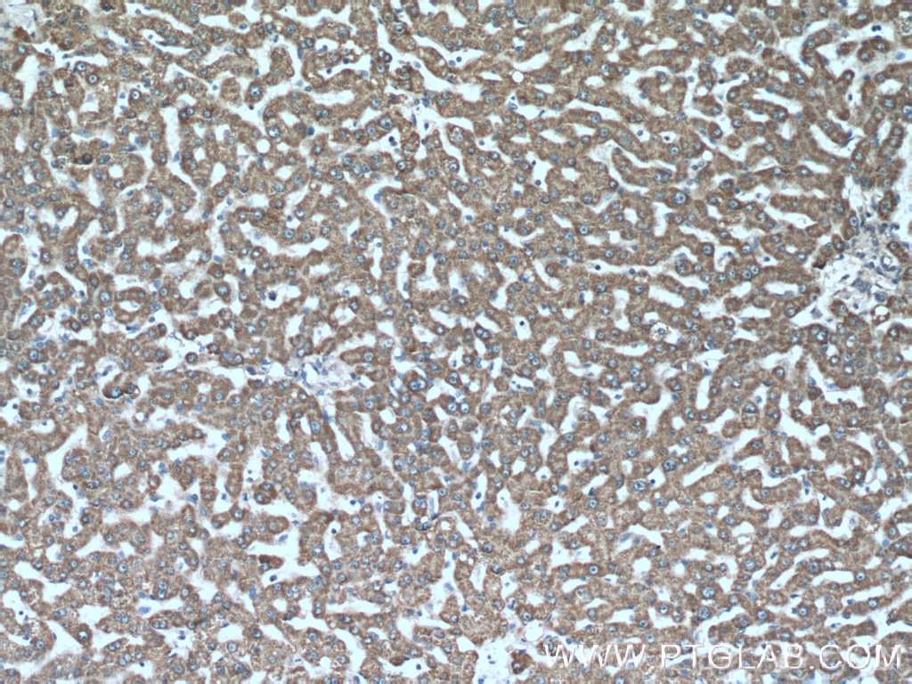 Immunohistochemistry (IHC) staining of human liver tissue using ISOC2 Polyclonal antibody (27082-1-AP)