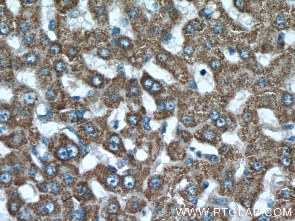 Immunohistochemistry (IHC) staining of human liver tissue using ISOC2 Polyclonal antibody (27082-1-AP)