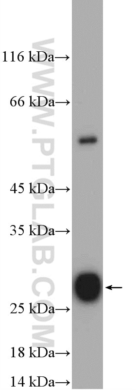 Western Blot (WB) analysis of mouse kidney tissue using ISOC2 Polyclonal antibody (27082-1-AP)