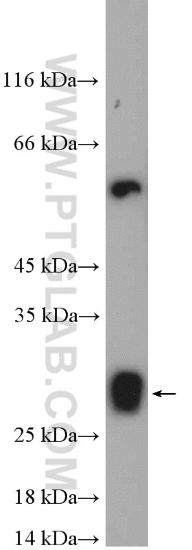 Western Blot (WB) analysis of mouse liver tissue using ISOC2 Polyclonal antibody (27082-1-AP)