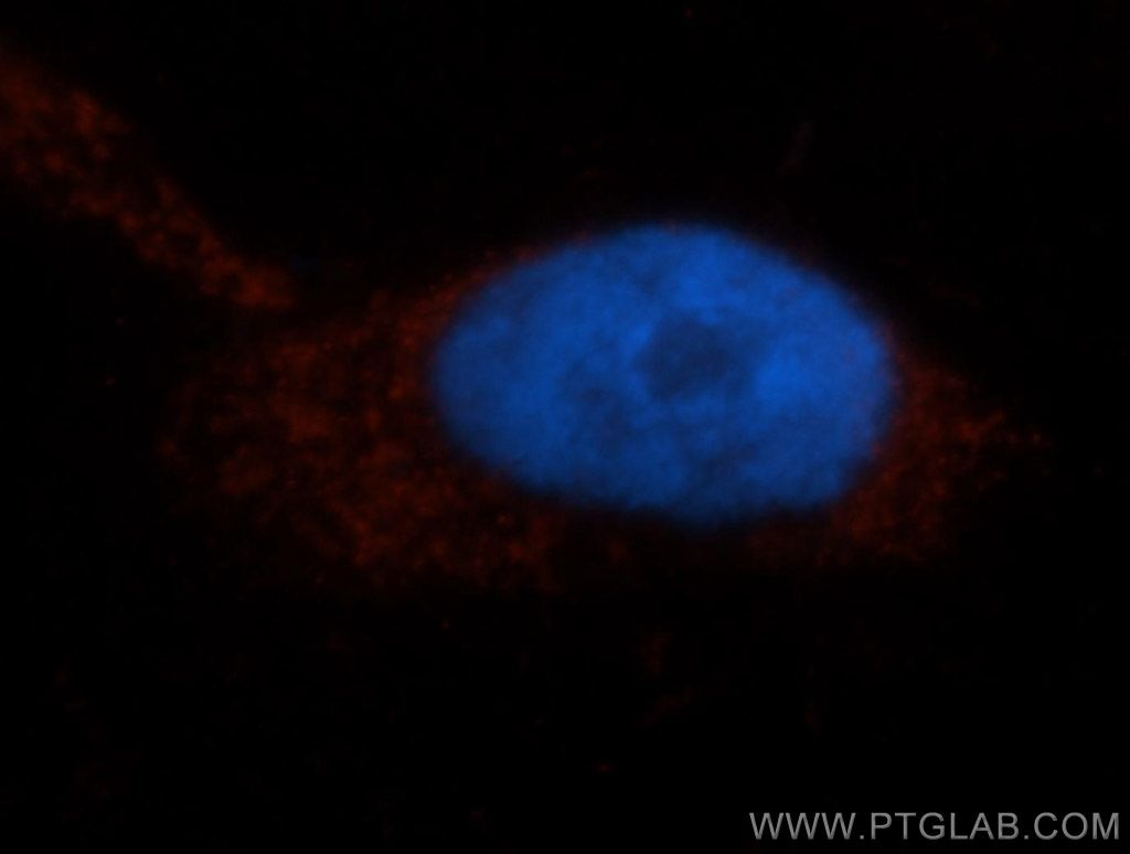 Immunofluorescence (IF) / fluorescent staining of HepG2 cells using ISYNA1 Polyclonal antibody (14142-1-AP)