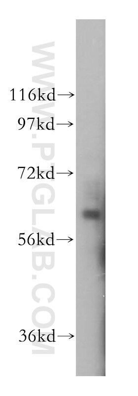 Western Blot (WB) analysis of HepG2 cells using ISYNA1 Polyclonal antibody (14142-1-AP)