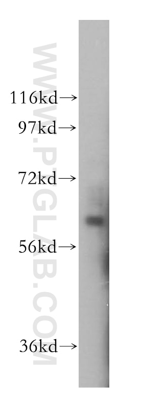 WB analysis of HepG2 using 14142-1-AP