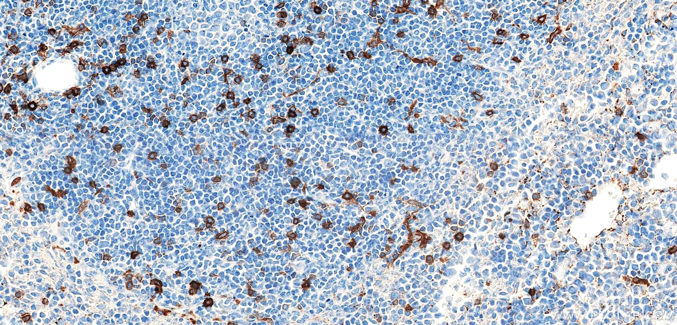 IHC staining of mouse spleen using 87417-1-RR Immunohistochemistry (IHC) staining of mouse spleen tissue using CD103 Recombinant monoclonal antibody (87417-1-RR)