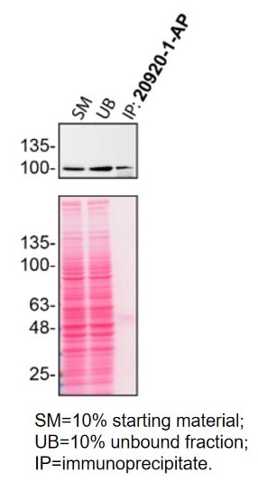 Immunoprecipitation (IP) experiment of HeLa cells using ITCH Polyclonal antibody (20920-1-AP)