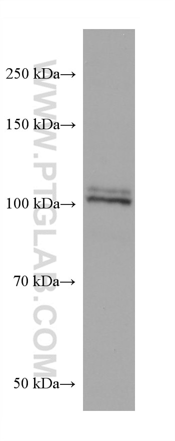 Western Blot (WB) analysis of LNCaP cells using ITCH Monoclonal antibody (67757-1-Ig)
