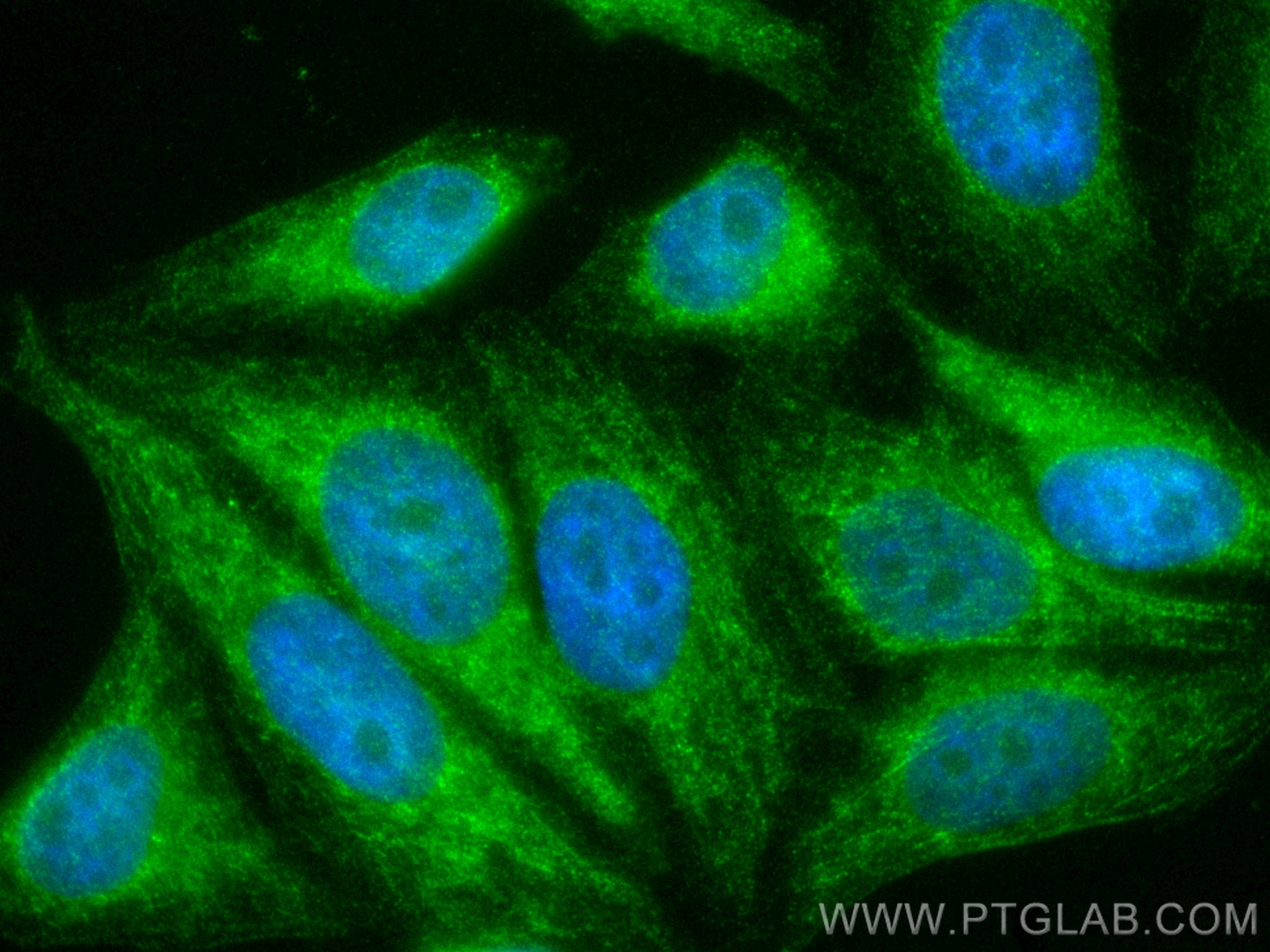 Immunofluorescence (IF) / fluorescent staining of HepG2 cells using CoraLite® Plus 488-conjugated ITCH Monoclonal anti (CL488-67757)