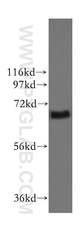 Western Blot (WB) analysis of mouse testis tissue using ITFG1 Polyclonal antibody (11731-1-AP)