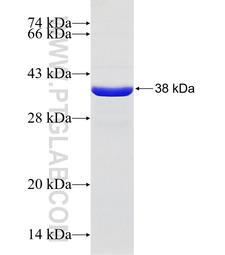 ITFG2 fusion protein Ag31267 SDS-PAGE