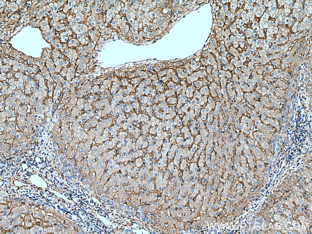 Immunohistochemistry (IHC) staining of human liver tissue using Integrin alpha-1 Polyclonal antibody (22146-1-AP)