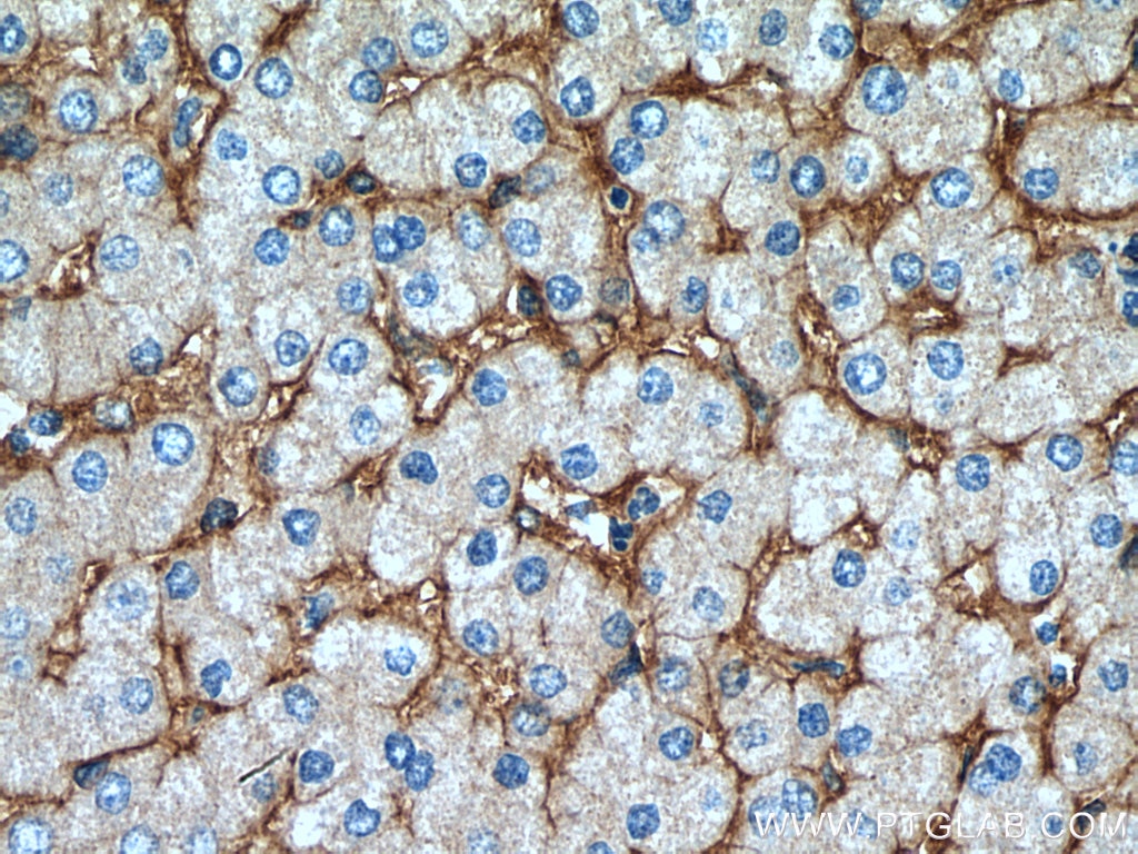 Immunohistochemistry (IHC) staining of human liver tissue using Integrin alpha-1 Polyclonal antibody (22146-1-AP)