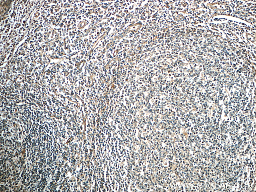 Immunohistochemistry (IHC) staining of human tonsillitis tissue using Integrin alpha-1 Polyclonal antibody (22146-1-AP)