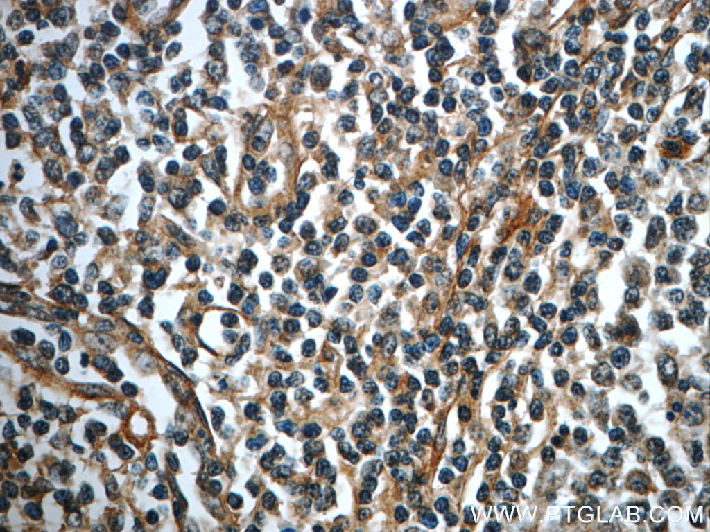 Immunohistochemistry (IHC) staining of human tonsillitis tissue using Integrin alpha-1 Polyclonal antibody (22146-1-AP)