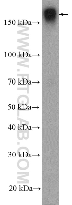 Western Blot (WB) analysis of HeLa cells using Integrin alpha-1 Polyclonal antibody (22146-1-AP)