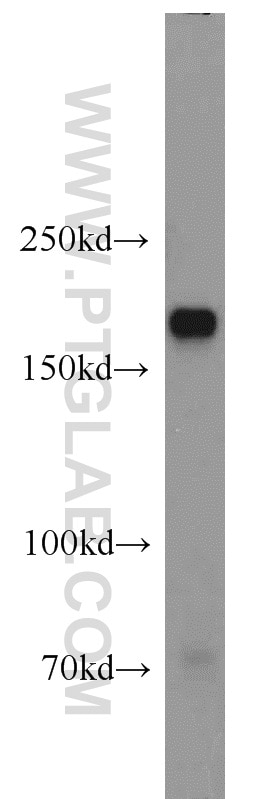 Western Blot (WB) analysis of HepG2 cells using Integrin alpha-1 Polyclonal antibody (22146-1-AP)